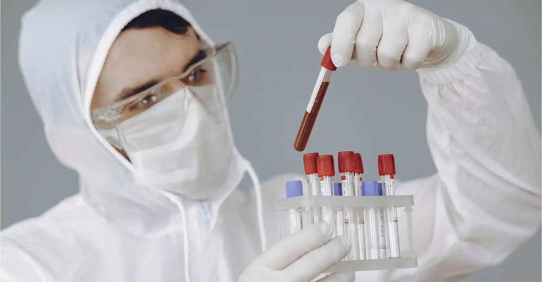 COVID-19: Opinia expertilor in tromboza