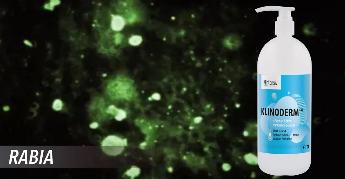 Rabia (Turbarea): Cauze, Simptome, Transmitere, Tratament si Preventie