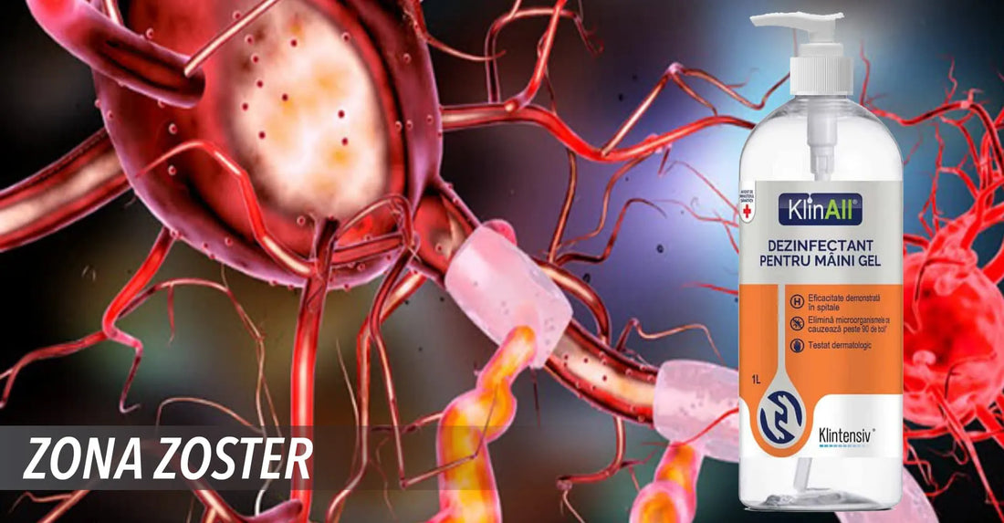 Zona Zoster (Herpes Zoster): Cauze, Simptome, Transmitere, Tratament si Preventie